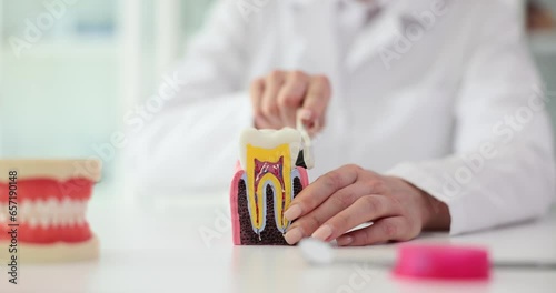 Dentist cleans artificial model of tooth with toothbrush in examination room. Doctor practitioner demonstrates right care for teeth in clinic slow motion photo