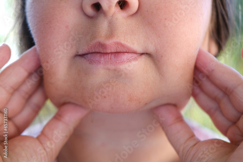 Tableau sur toile Double chin face mature woman 50 years old, human fat neck, sagging cheeks, wrin