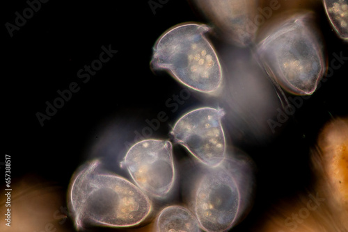 Study of Protozoa and Algae under the microscope for education. photo