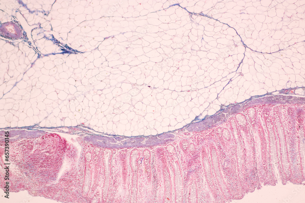 Fototapeta premium Histological Rectum human, Gall bladder human and Urethra Human under the microscope for education.