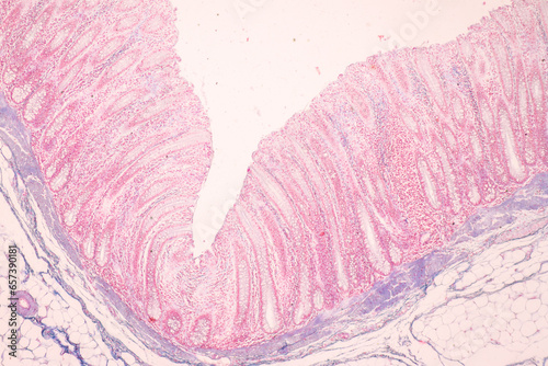 Histological Rectum human, Gall bladder human and Urethra Human under the microscope for education. photo