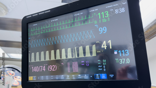 Medical monitor displays vital signs with graphs and numbers, heart rate, blood pressure, temperature, conveying health data, technology, healthcare, and patient monitoring concepts