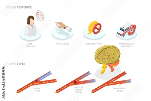 Φωτογραφία 3D Isometric Flat  Conceptual Illustration of Brain Blood Supply Problem, Ischem