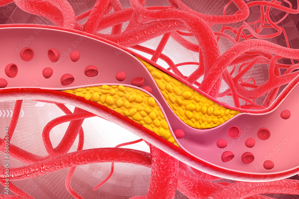 Clogged arteries on scientific background. 3d illustration..