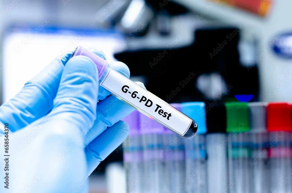 Blood sampling tube for G-6-PD analysis. Blood sampling tube for G-6-PD analysis.