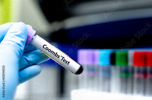 Blood sampling tube for Coombs'test analysis. photo
