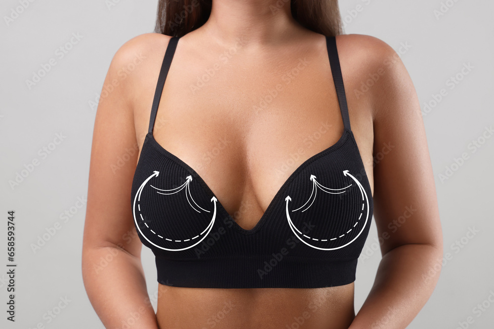 Breast surgery. Woman with markings on bra against light background, closeup
