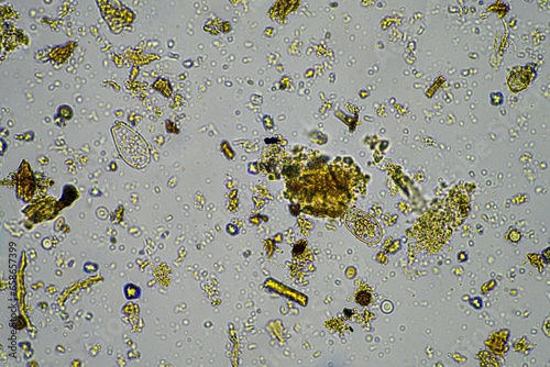 Microorganisms and biology in Compost and soil sample under the microscope photo