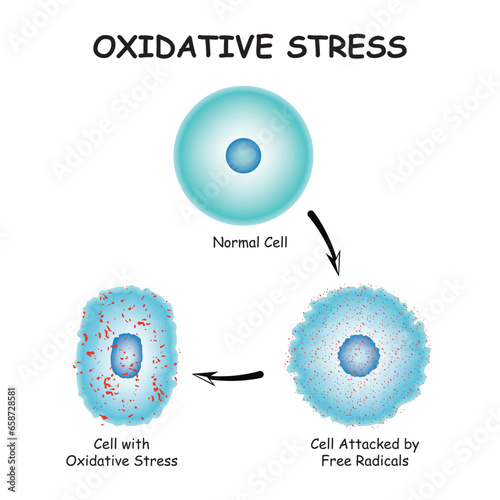 Oxidative stress diagram vector illustration design, Oxidative stress. From Normal cells to Oxidative stress and aggressive free radicals, cell death. Vector diagram for your design, educational photo