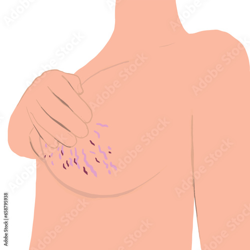 stretch marks on breasts vector illustration. Naked woman with stretch marks