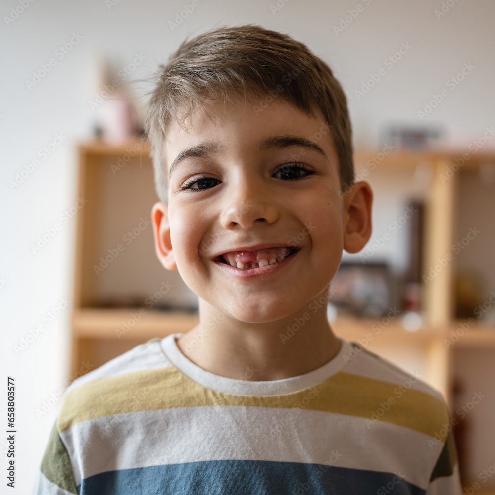boy with Deciduous primary milk teeth lost tooth fallen out dropped