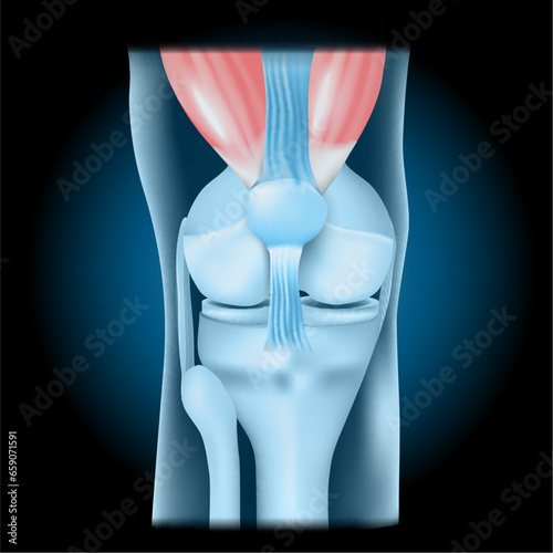 Knee joint with Quadriceps