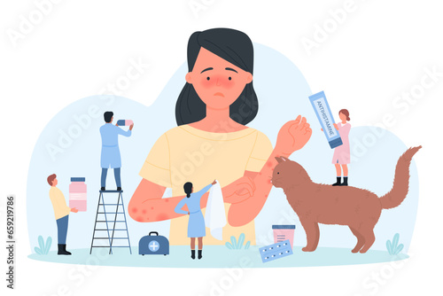 Allergy to pet fur vector illustration. Cartoon tiny people give tissue to girl with runny nose, antihistamine therapy and pills for treatment pain and inflammation, symptoms of cat hair intolerance