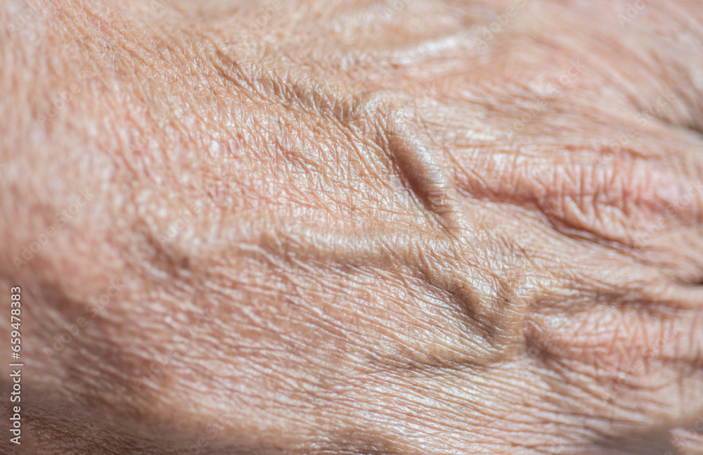 close up of human skin and veins