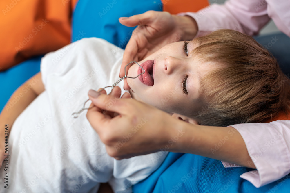Speech therapist using logopedic probe on session with little boy. Speech therapy tongue massage to a child with a staging probe. Female physiotherapist working on speech defects with preschool boy. Speech therapist using logopedic probe on session with little boy. Speech therapy tongue massage to a child with a staging probe. Female physiotherapist working on speech defects with preschool boy.