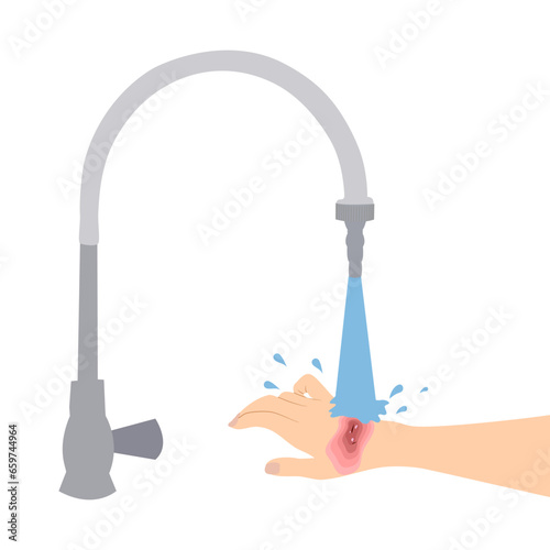 First aid for irritated skin is washing the irritated area with running water for minimum 15 minutes