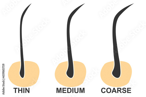 Canvas Print Hair thickness types classification set