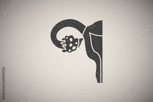 Ovulatory dysfunction icon vector illustration in stamp style photo