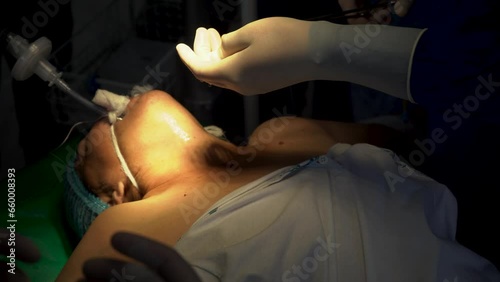 open surgery of a thyroidectomy photo