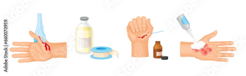Hands with Injured Skin and Wound First Aid Vector Set