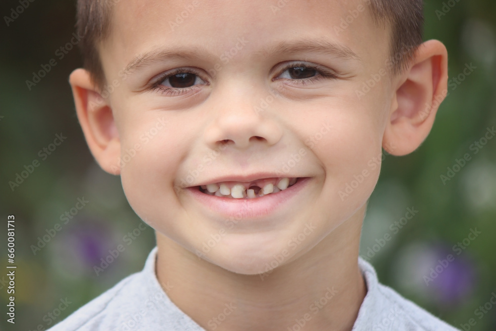 a boy without a tooth. Selective focus. a boy without a tooth. Selective focus.
