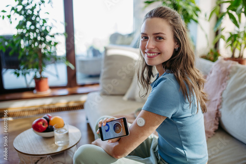 Woman with diabetes using continuous glucose monitor. Diabetic woman connecting CGM to smartphone to monitor her blood sugar levels in real time. photo