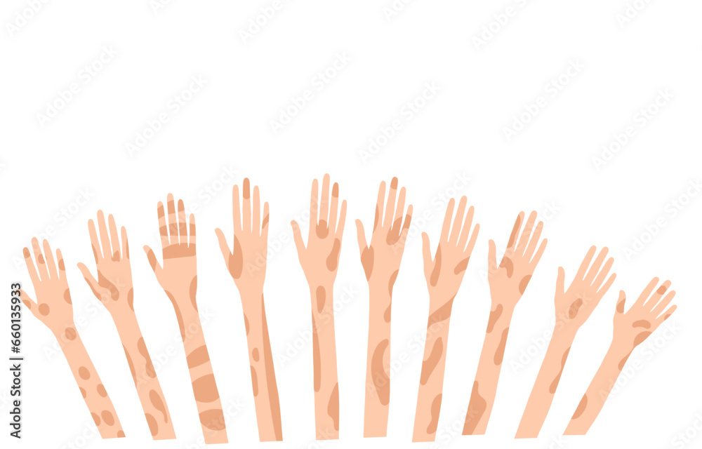 Vector background with skin-spotted hands