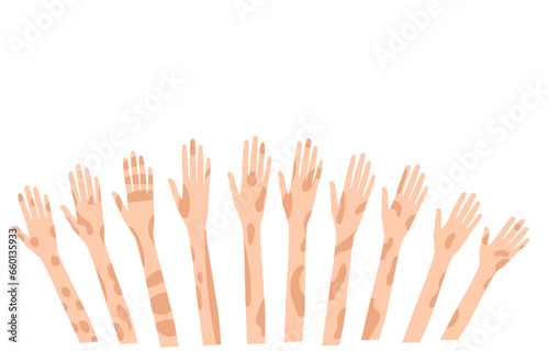 Vector background with skin-spotted hands