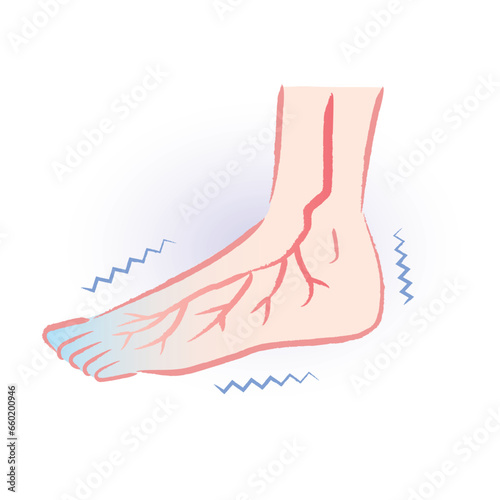 末端冷え性　血流の悪い冷えた足先のイラスト