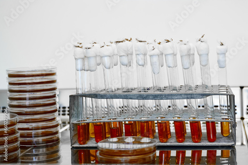 Test tubes with bacteriological cultures installed in tripod