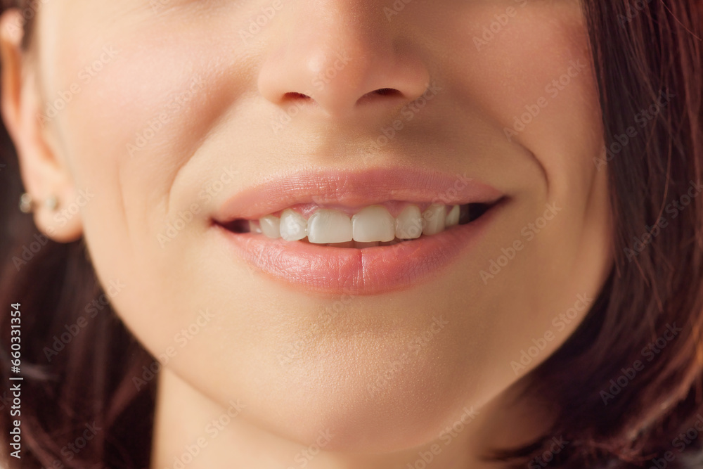 Close up cropped photo of young smiling with teeth female face, lips without lipstick. Natural gloss of lips and woman's skin. Increase in lips, cosmetology. Close up cropped photo of young smiling with teeth female face, lips without lipstick. Natural gloss of lips and woman's skin. Increase in lips, cosmetology.