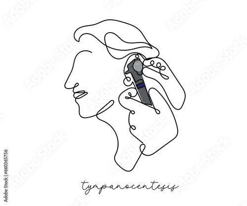 line art vector of a person suffering from tinnitus. Need of otoscopy. Ear exam concept art.