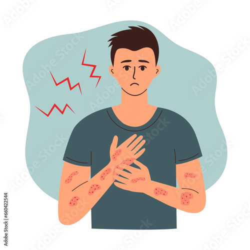 Sad man suffering from psoriasis, eczema or dermatitis scratches rashes on his hand. Skincare, medicine and healthcare concept.