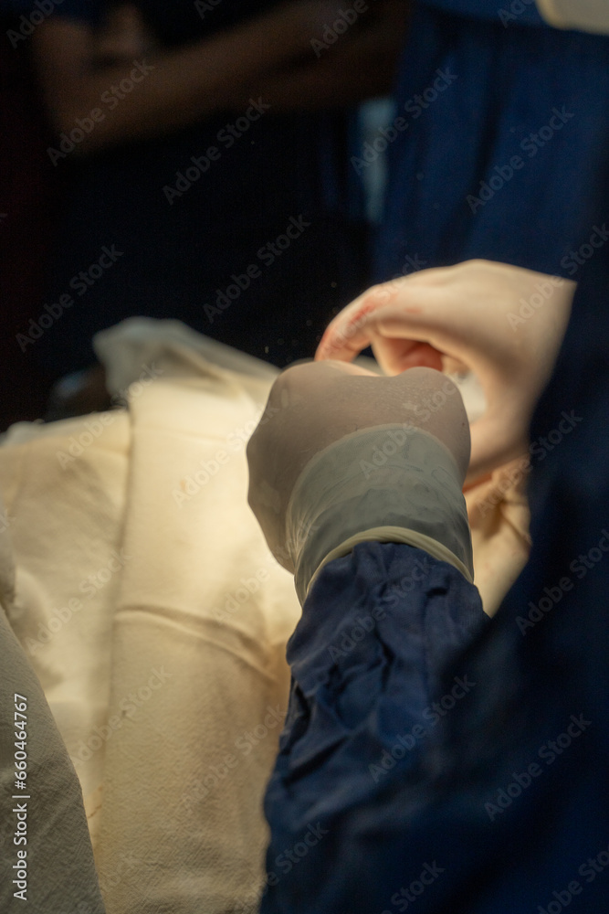 Many doctors are doing surgery with great patience Many doctors are doing surgery with great patience