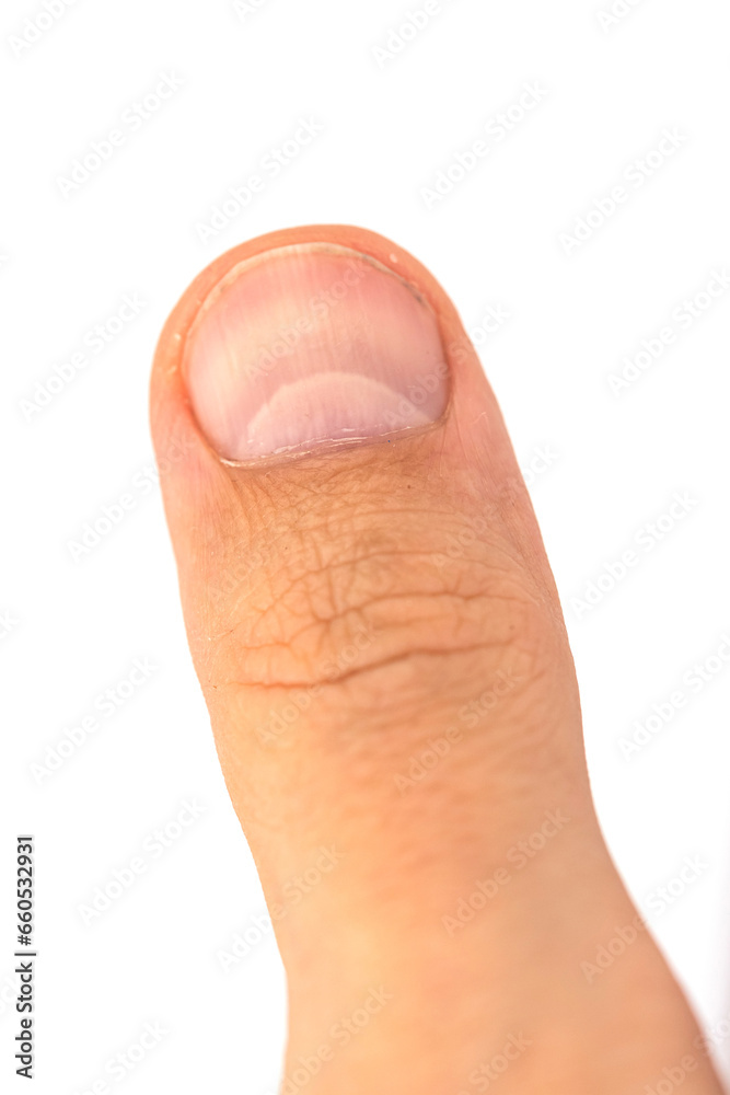the large man thumb finger