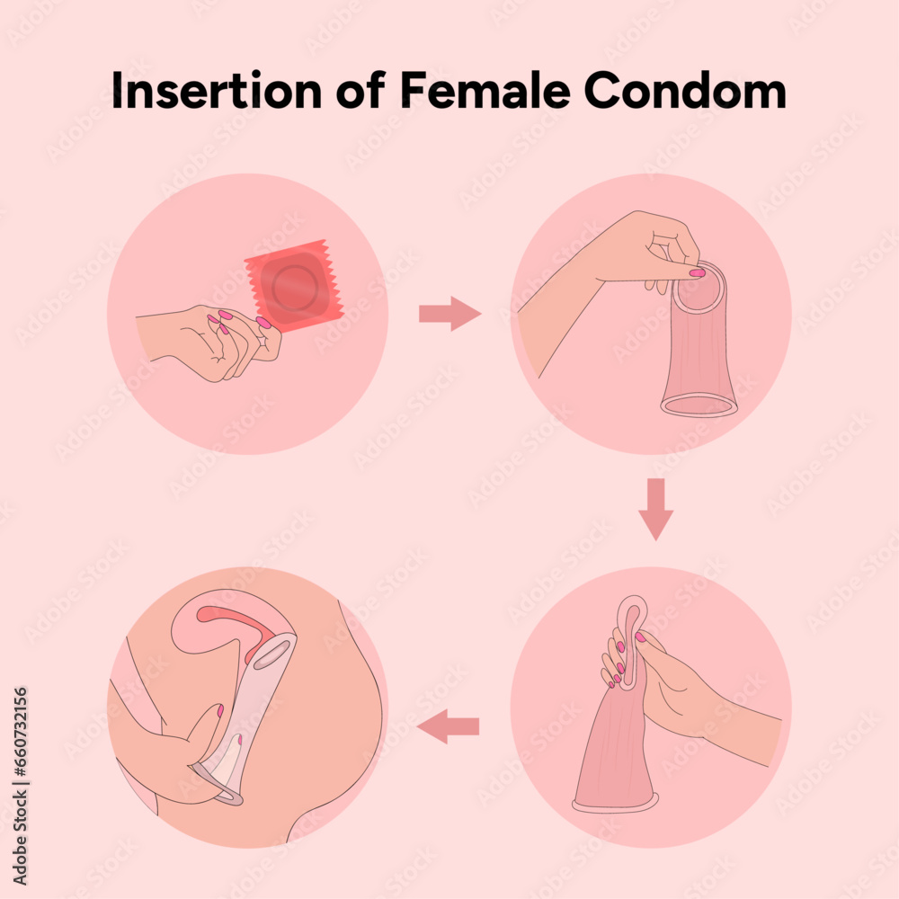 Insertion of female condom, how to use womans condoms