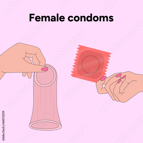 Female condoms, gynecology illustration