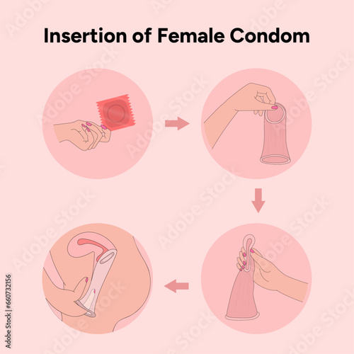 Insertion of female condom, how to use womans condoms