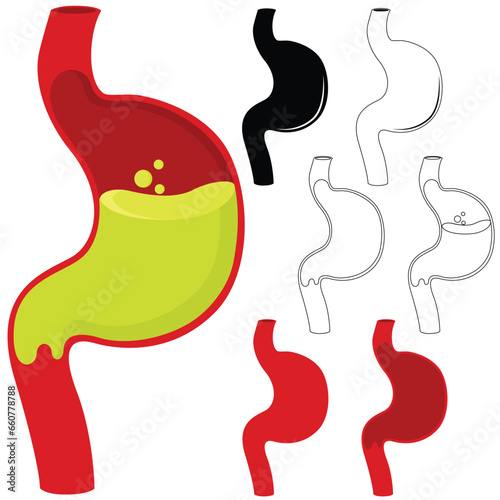 Set of stomach vector illustration. Human stomach organ. Acid reflux on stomach clipart