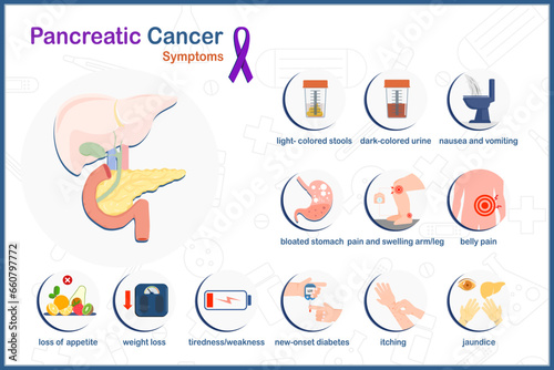 Vector medical illustration in pancreatic cancer concept. Symptoms of pancreatic cancer in flat style, isolated on white background and purple ribbon symbol of pancreatic cancer.