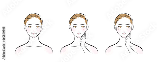 肌トラブルを抱える女性の顔のカラーイラスト1