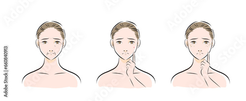 肌トラブルを抱える女性の顔のカラーイラスト2