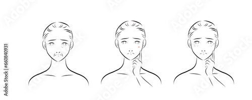 肌トラブルを抱える女性の顔のイラスト