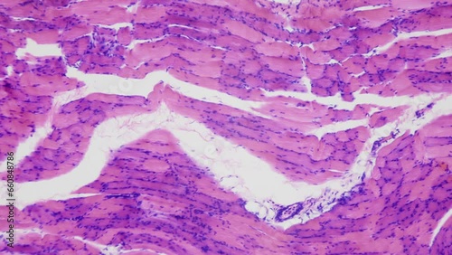 Bodybuilder muscles. Effect of Anabolics and growth hormones. Human skeletal muscle tissue under microscope, 400x times magnification. Longitudinal section. Smooth focusing and movement photo