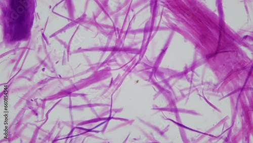 Human smooth muscle fibers under a microscope. The main muscle of the human internal organs from the intestines to the bladder, etc. photo