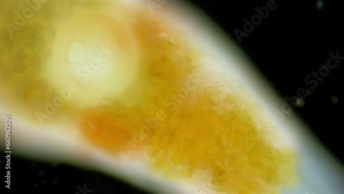 Parasitic worm Progonus muelleri under a microscope, at metacercaria stage. Class Trematoda. White Sea photo