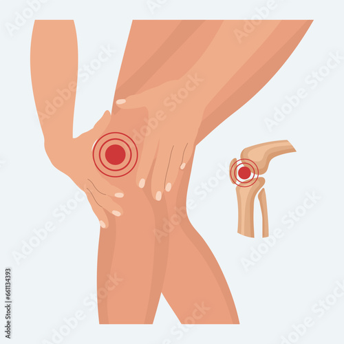 Pain in the knee joint, knee arthritis, leg pain due to rheumatoid arthritis. Anatomy of human bones. Illustration, vector