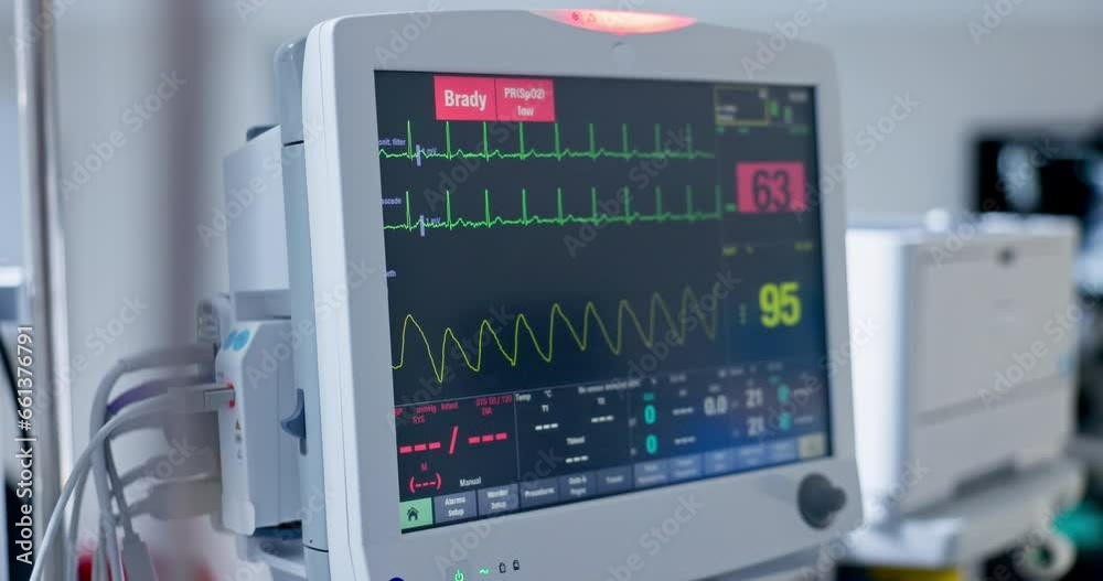Cardiac Tech Machine Hospital, digital machine or heart monitor in theater, bcakground or ...