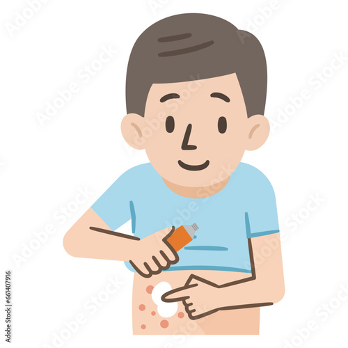 湿疹に薬を塗る男性のイラスト