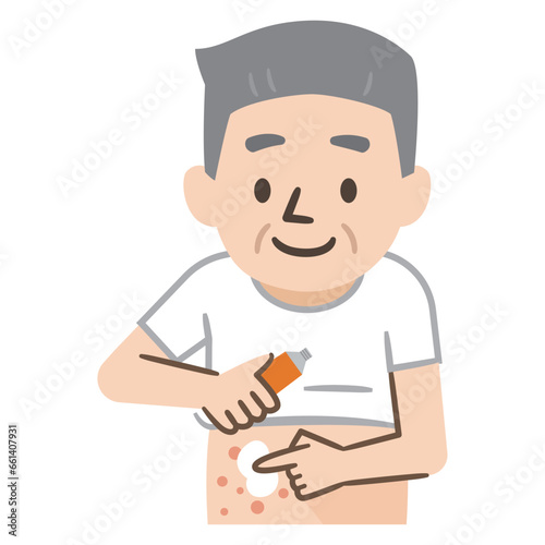 湿疹に薬を塗るシニア男性のイラスト